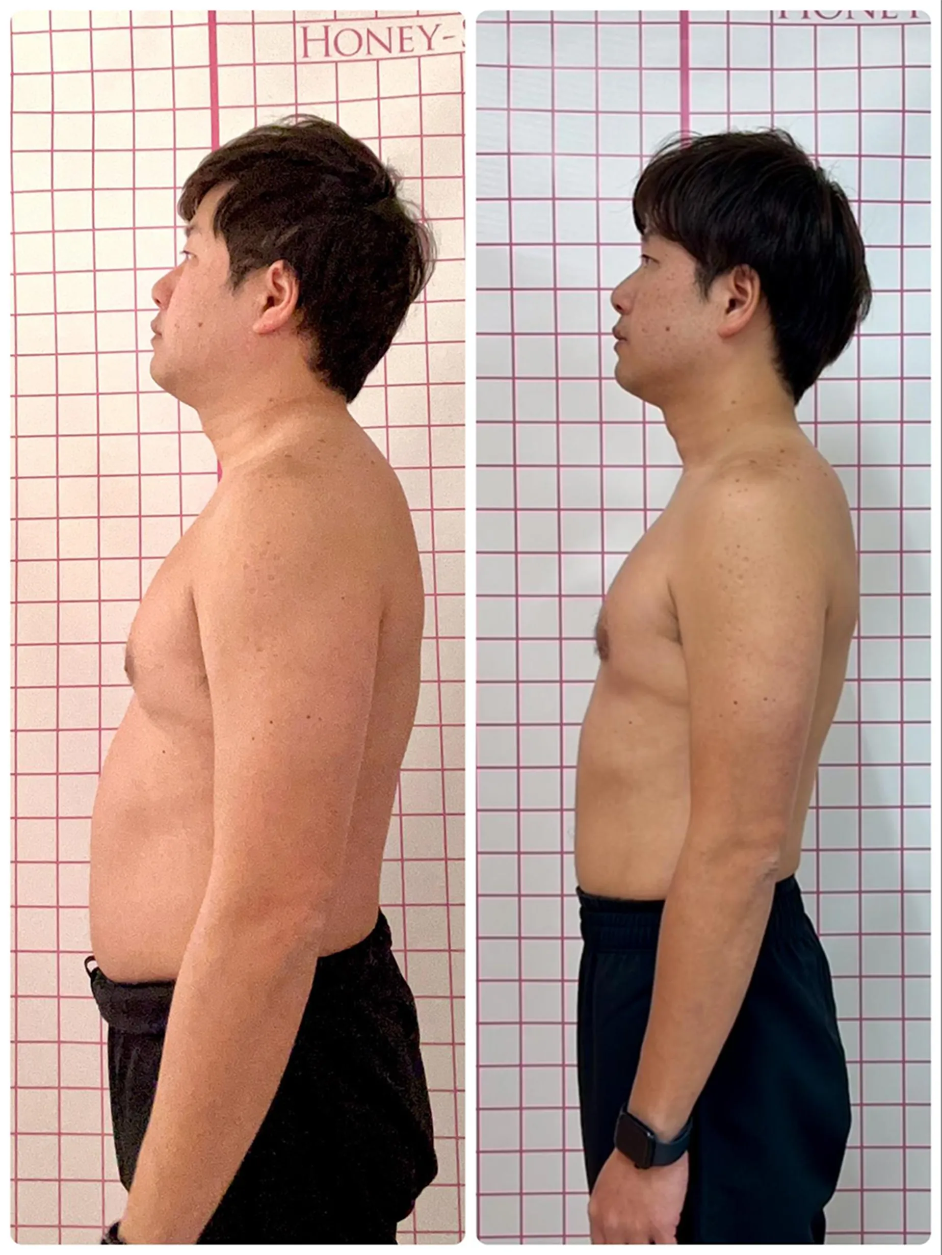 beforeAfter
