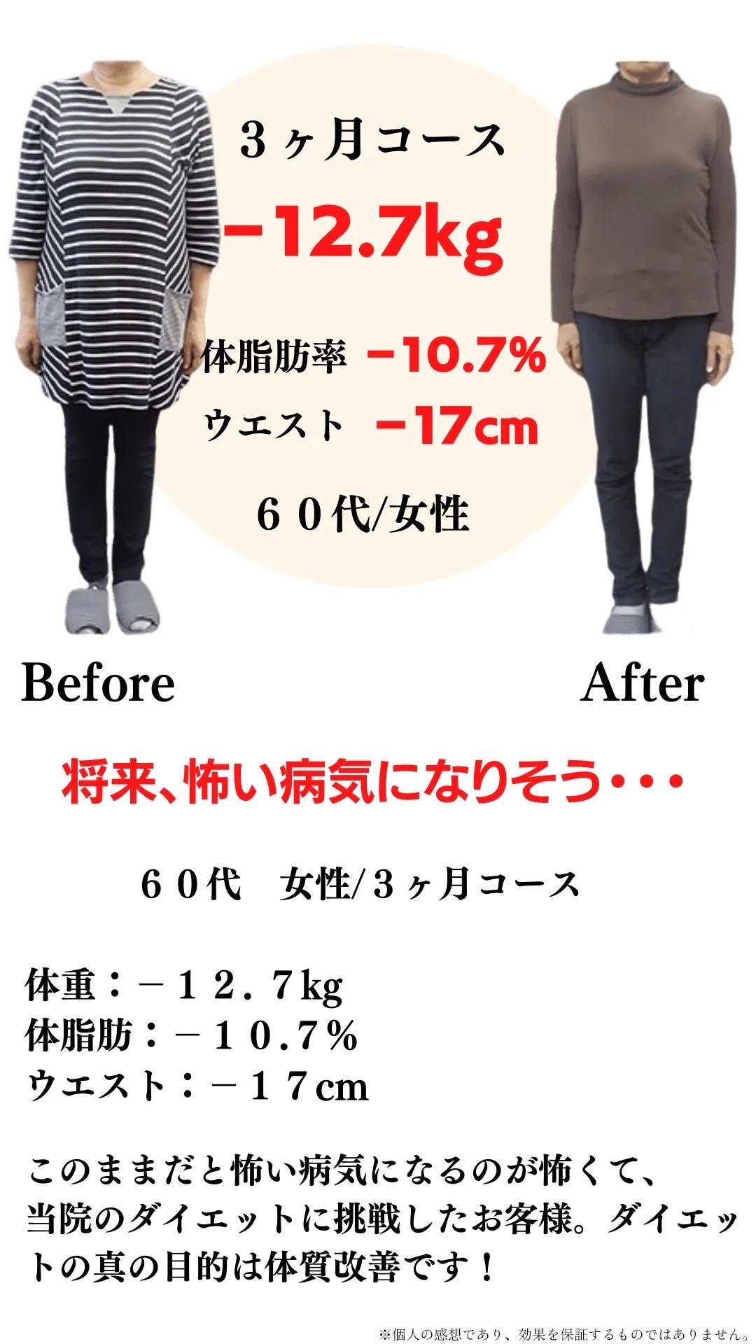 ビフォーアフター4