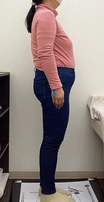 ダイエットに成功したお客様のビフォー1