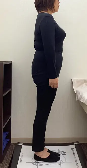 ダイエットに成功されたお客様アフターの写真