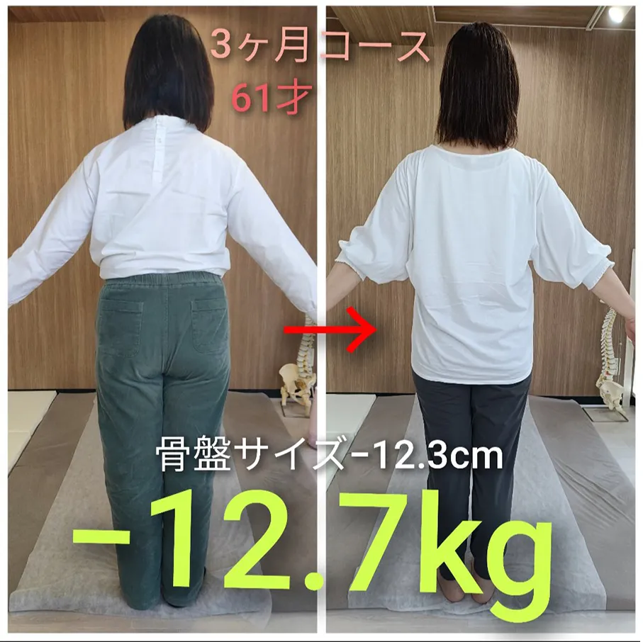 ビフォーアフター