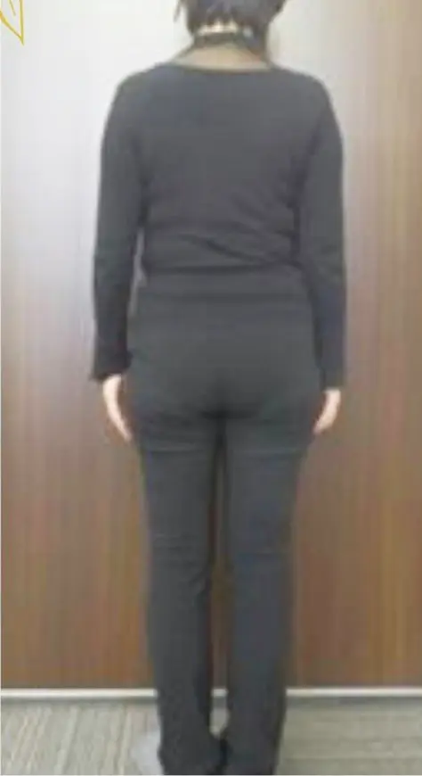 ビフォー