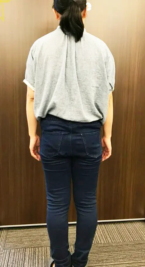 ビフォー