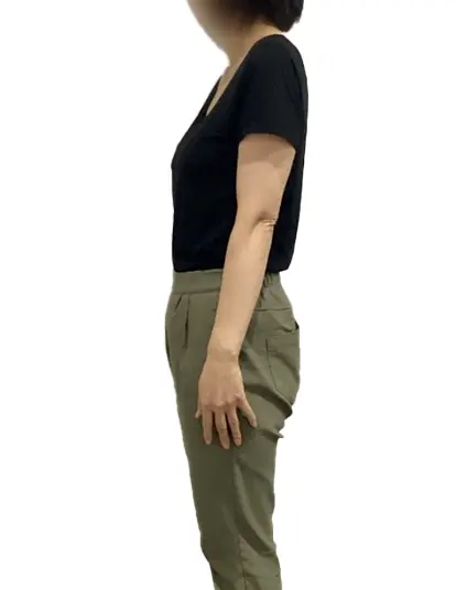 ビフォーアフター画像