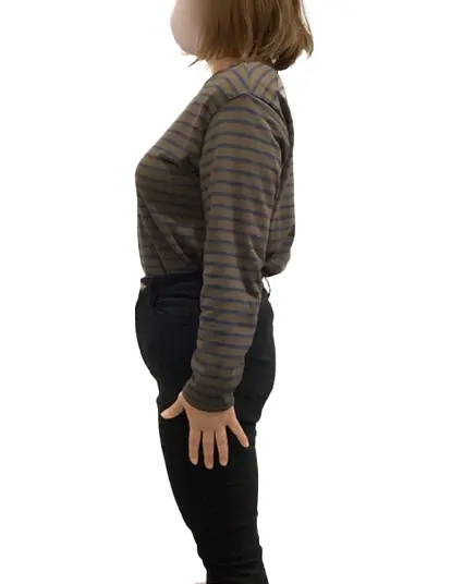 ビフォーアフター画像