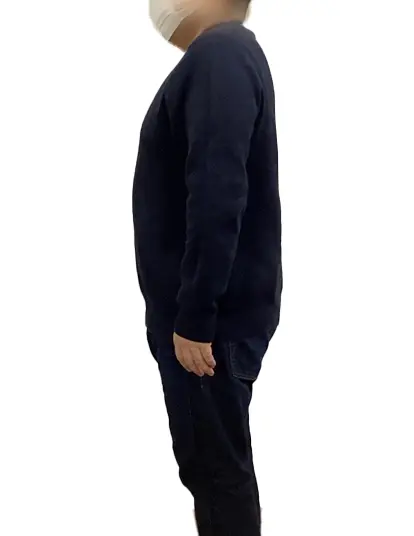 ビフォーアフター画像