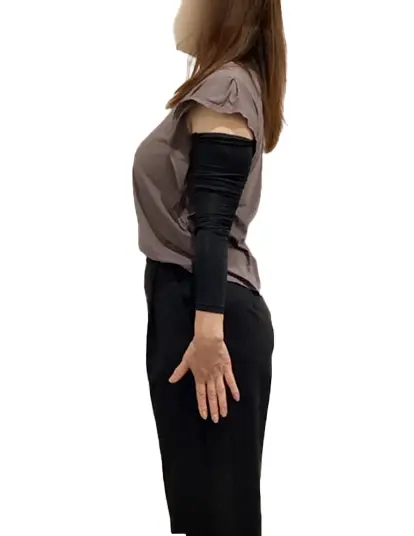 ビフォーアフター画像