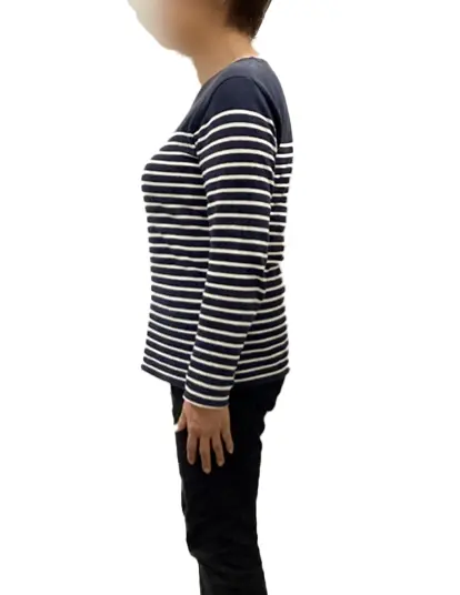 ビフォーアフター画像