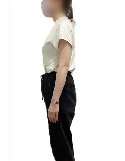 ビフォーアフター画像