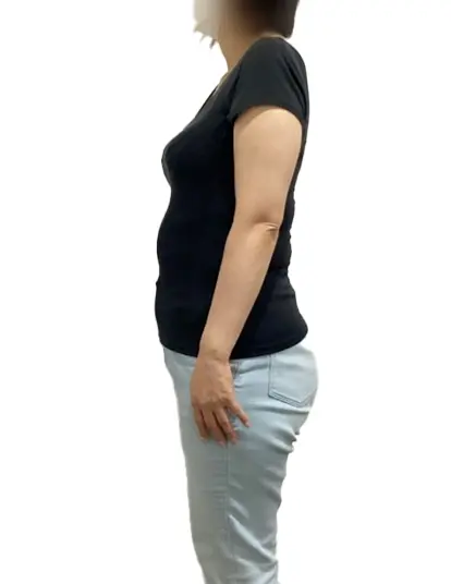 ビフォーアフター画像