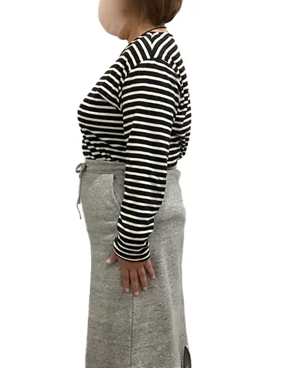 ビフォーアフター画像