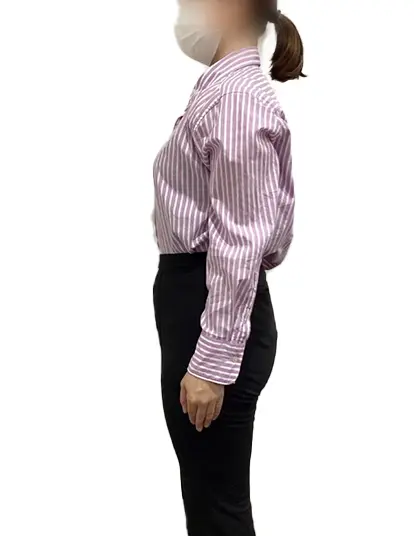 ビフォーアフター画像