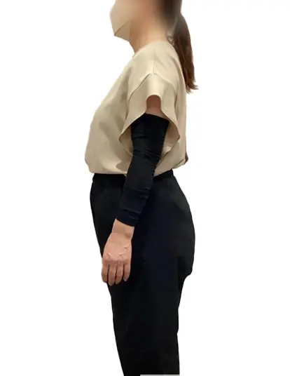 ビフォーアフター画像