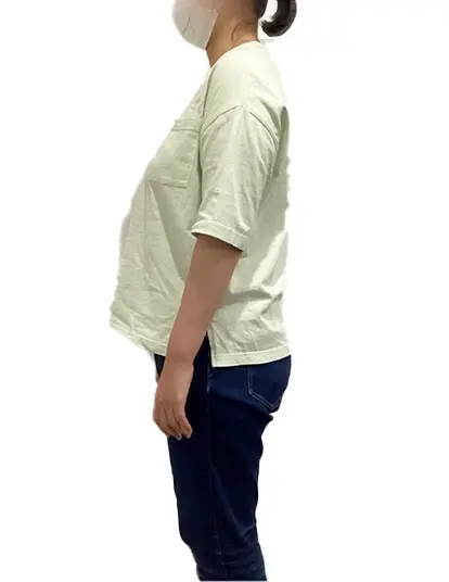 ビフォーアフター画像