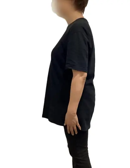 ビフォーアフター画像