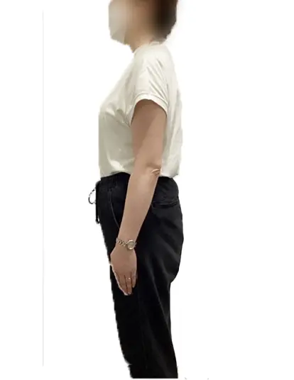 ビフォーアフター画像