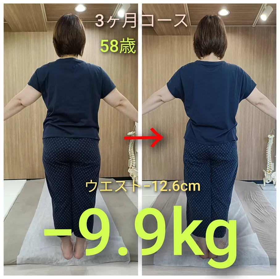 ビフォーアフター