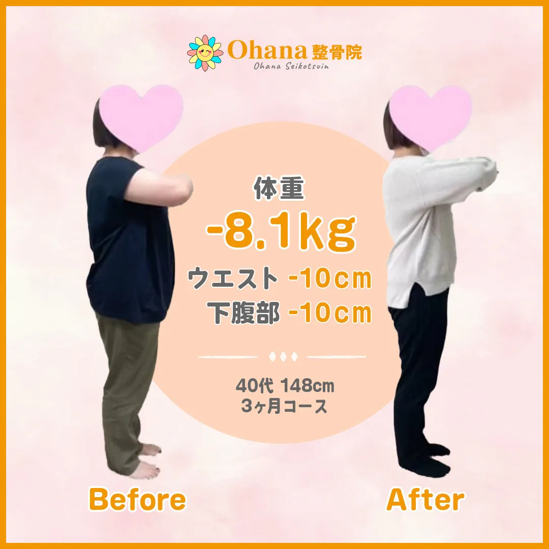 beforeAfter