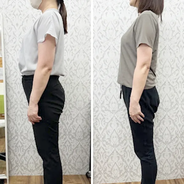 ビフォーアフター