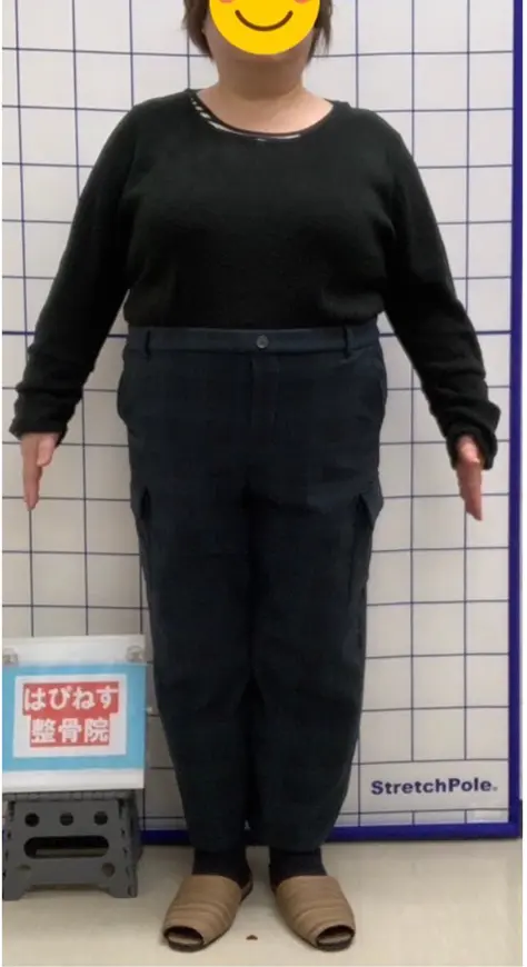 ビフォー