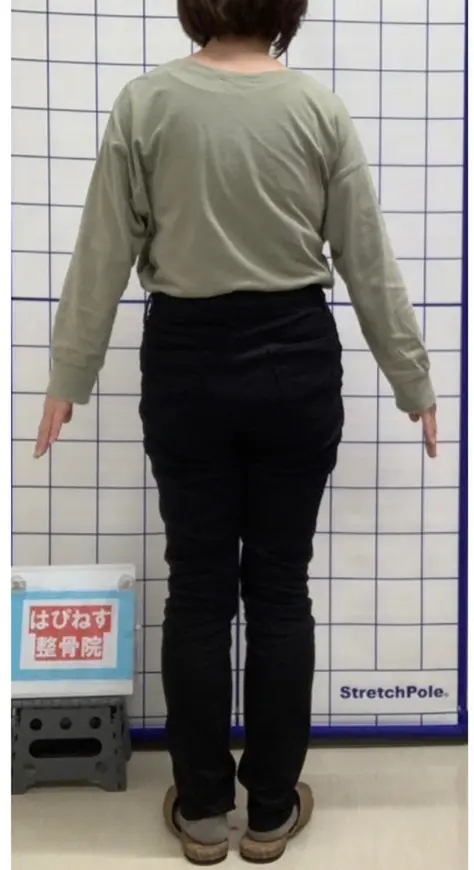 アフター