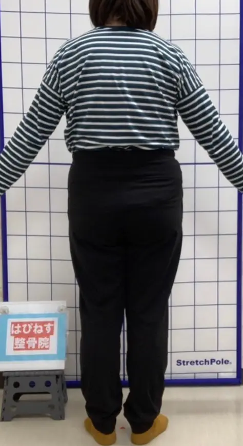 ビフォー