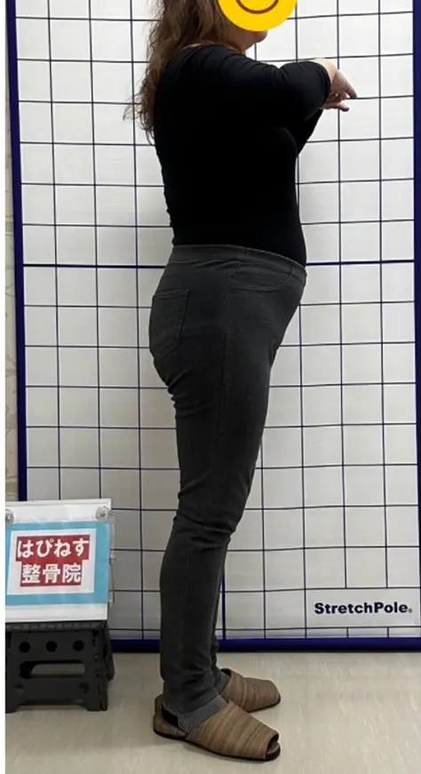 ビフォー