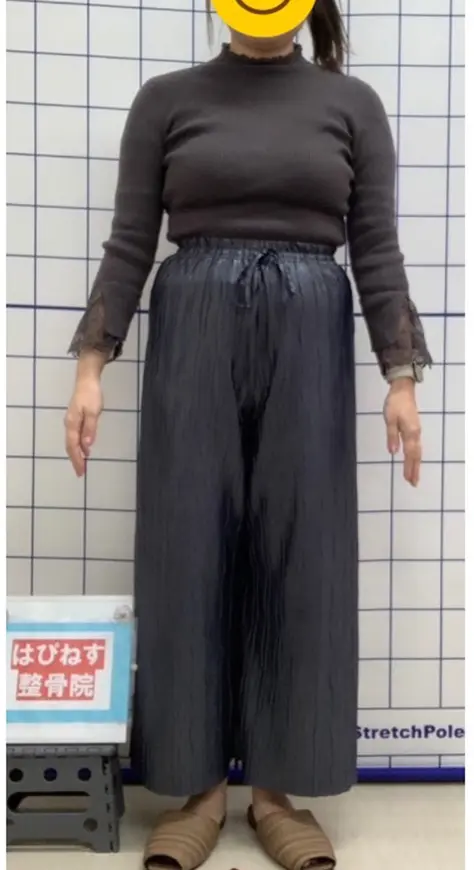 ビフォー