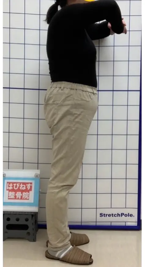 ビフォー