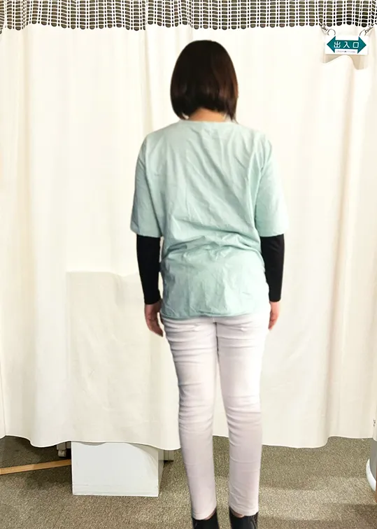 ビフォーアフター画像