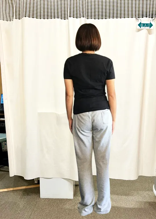 ビフォーアフター画像