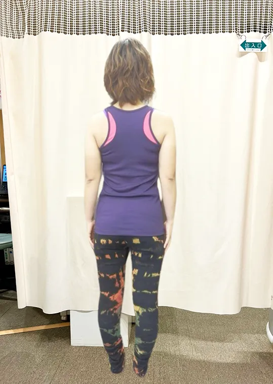 ビフォーアフター画像