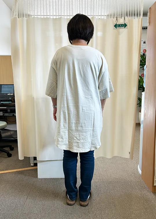 ビフォーアフター画像