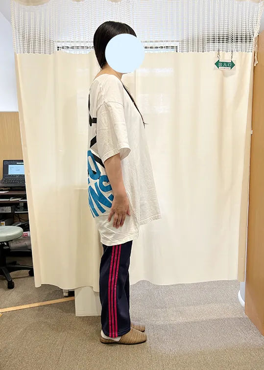 ビフォーアウター画像