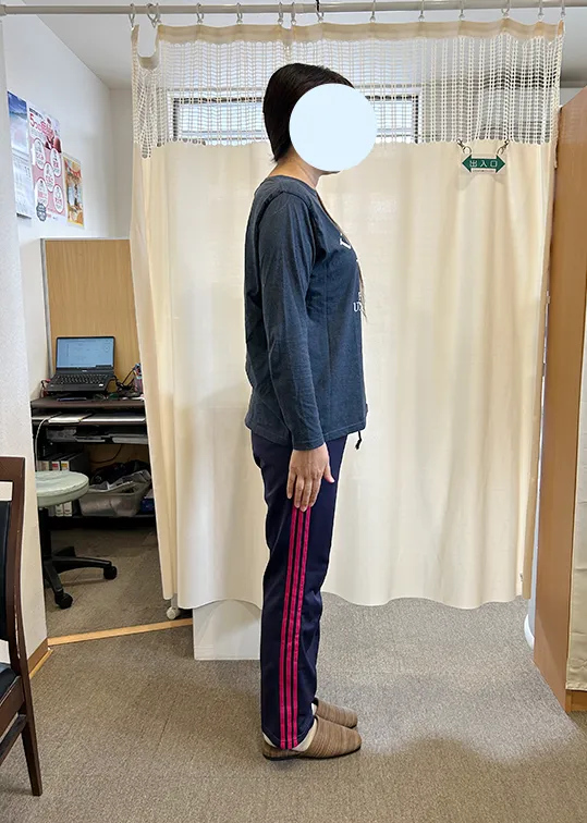 ビフォーアウター画像