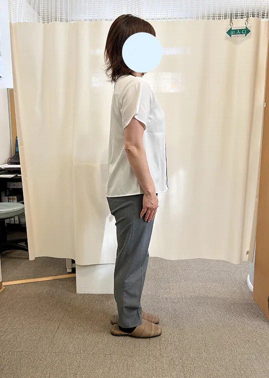 ビフォーアウター画像