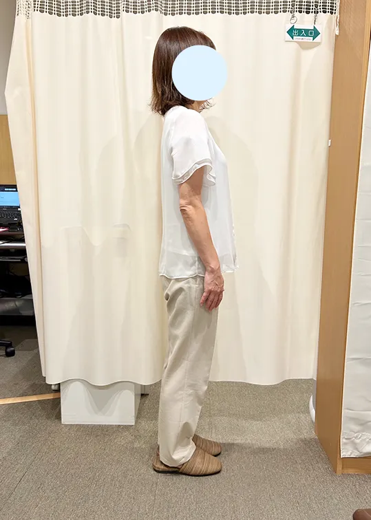 ビフォーアウター画像