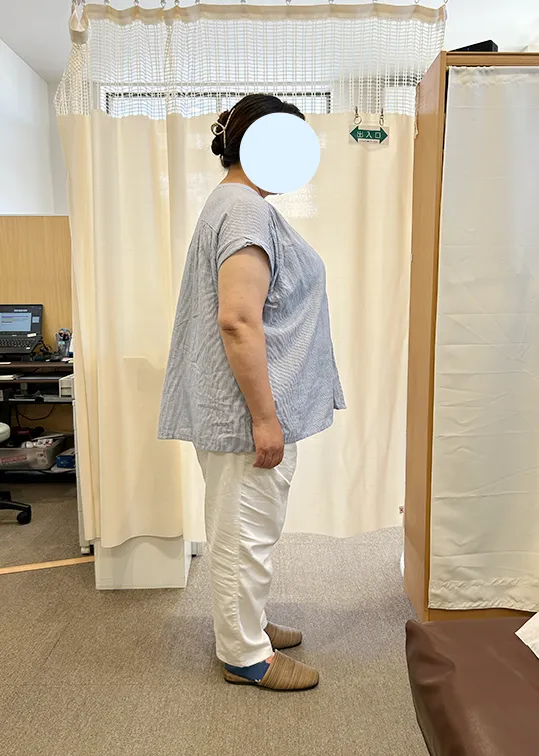 ビフォーアウター画像