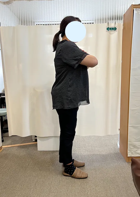 ビフォーアウター画像