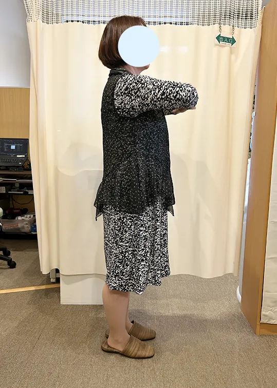 ビフォーアウター画像