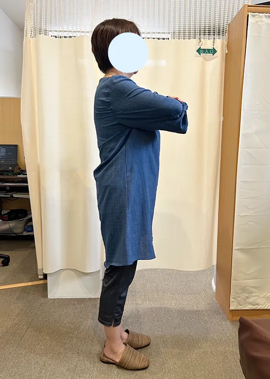 ビフォーアウター画像