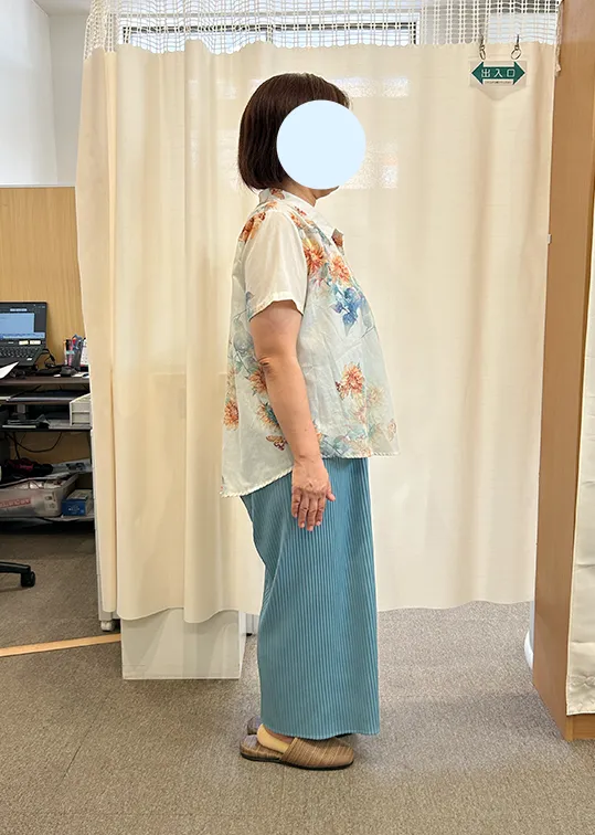 ビフォーアフター画像