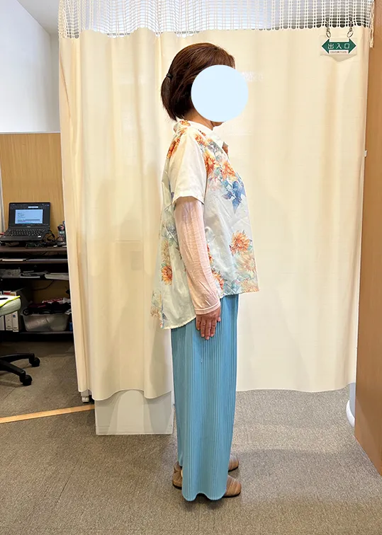 ビフォーアフター画像