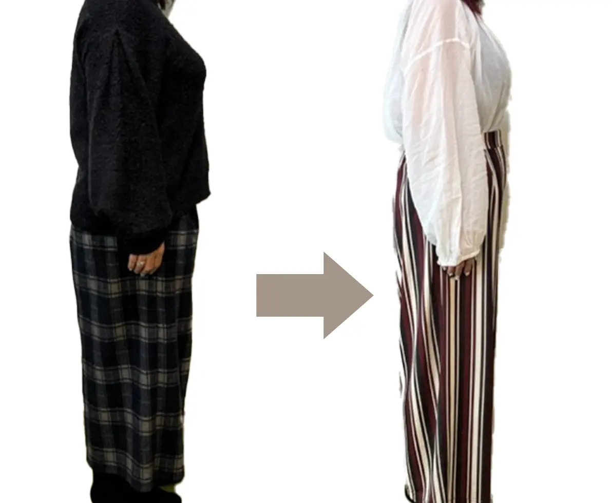 ビフォーアフター