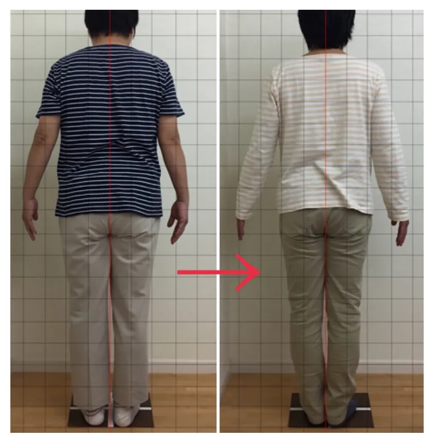 ビフォーアフター